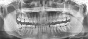 radiologia-odontologica-4